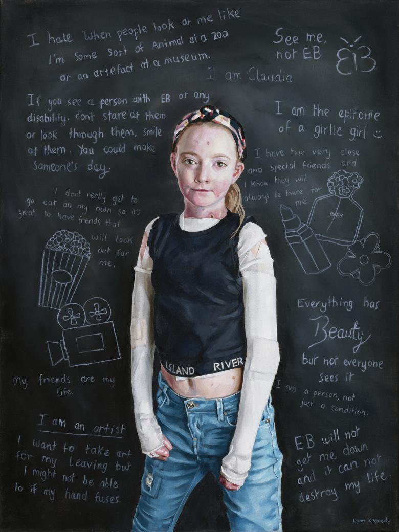 A young girl dressed in blue jeans and a black vest stands in front of a blackboard. She has dressings on her arms and visible under her vest, and we can see a few blisters on her skin. The blackboard behind her is covered in writing, all about the personality of Claudia, the subject of the portrait. 