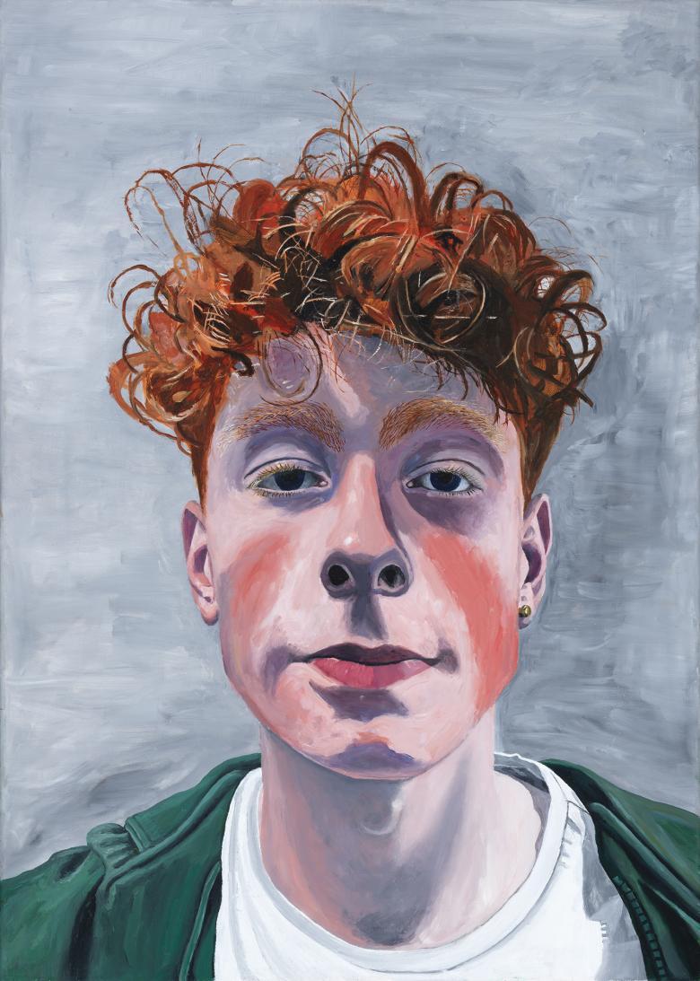 An oil portrait of a young man with red, curly hair. He has red marks on his cheeks, and looks directly at the viewer. The portrait is cropped, so we see his head, and a glimpse of what he is wearing - a white t-shirt and a green hooded top.