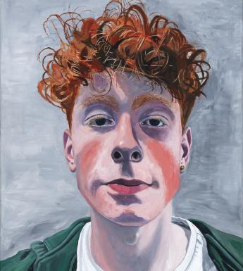 An oil portrait of a young man with red, curly hair. He has red marks on his cheeks, and looks directly at the viewer. The portrait is cropped, so we see his head, and a glimpse of what he is wearing - a white t-shirt and a green hooded top.