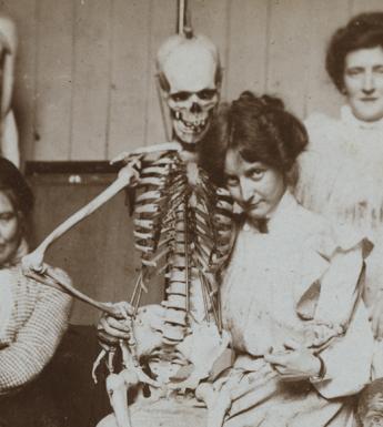 Vintage black and white photo of women posing with a medical skeleton model