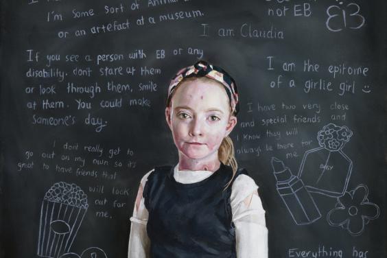 A young girl dressed in blue jeans and a black vest stands in front of a blackboard. She has dressings on her arms and visible under her vest, and we can see a few blisters on her skin. The blackboard behind her is covered in writing, all about the personality of Claudia, the subject of the portrait. 